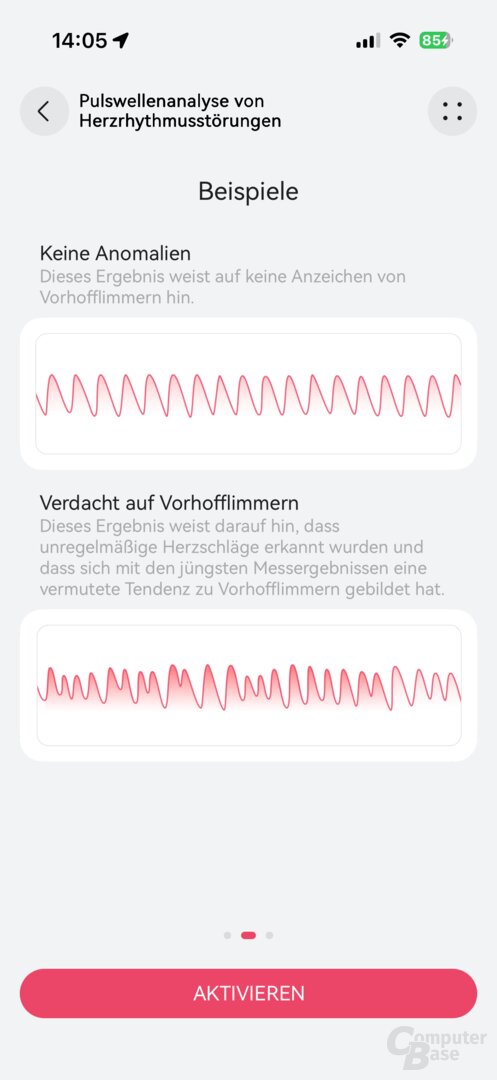 Herzrhythmusstörungen mit der Huawei Watch D2 erkennen