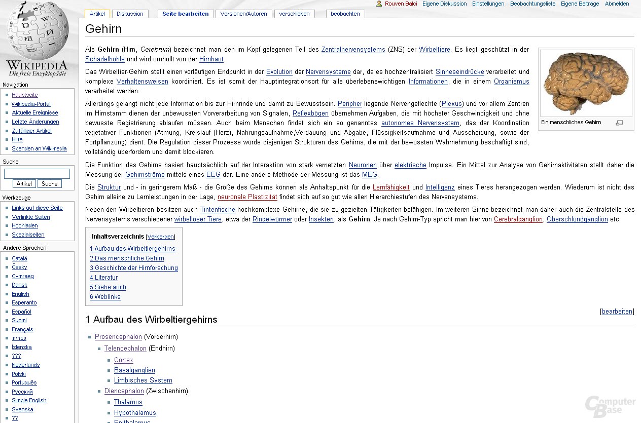 Inhaltsvergleich ("Gehirn"): Wikipedia