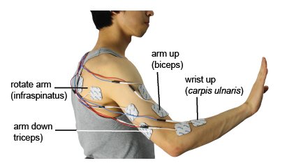 Platzierung der Elektroden zur Muskelstimulation