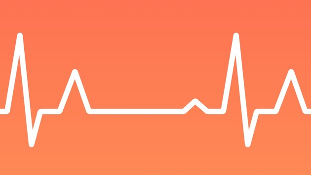 Wearable: Apple Watch soll in Zukunft EKG erstellen können