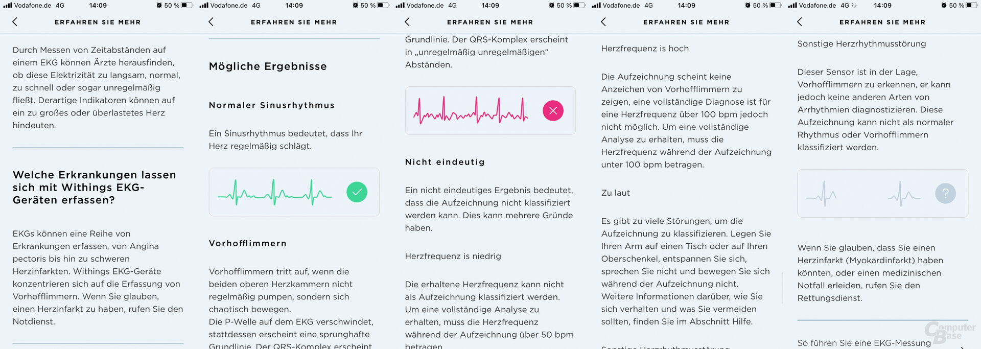 Withings Health Mate App: Erläuterungen zum EKG