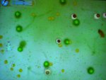spore_amoeba.jpg